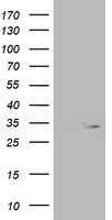 OXNAD1 Antibody - HEK293T cells were transfected with the pCMV6-ENTRY control (Left lane) or pCMV6-ENTRY OXNAD1 (Right lane) cDNA for 48 hrs and lysed. Equivalent amounts of cell lysates (5 ug per lane) were separated by SDS-PAGE and immunoblotted with anti-OXNAD1.