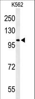 OXR1 Antibody - Western blot of OXR1 Antibody in K562 cell line lysates (35 ug/lane). OXR1 (arrow) was detected using the purified antibody.
