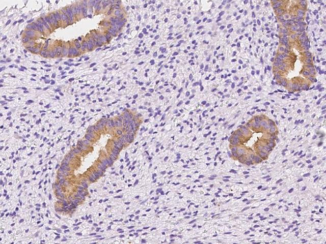 OXR1 Antibody - Immunochemical staining of human OXR1 in human corpus uteri with rabbit polyclonal antibody at 1:100 dilution, formalin-fixed paraffin embedded sections.