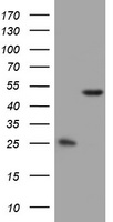 OXSM / KS Antibody - HEK293T cells were transfected with the pCMV6-ENTRY control (Left lane) or pCMV6-ENTRY OXSM (Right lane) cDNA for 48 hrs and lysed. Equivalent amounts of cell lysates (5 ug per lane) were separated by SDS-PAGE and immunoblotted with anti-OXSM.