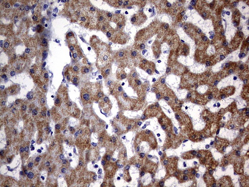 OXSM / KS Antibody - IHC of paraffin-embedded Human liver tissue using anti-OXSM mouse monoclonal antibody. (Heat-induced epitope retrieval by 1 mM EDTA in 10mM Tris, pH9.0, 120°C for 3min).
