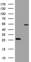 OXSM / KS Antibody - HEK293T cells were transfected with the pCMV6-ENTRY control (Left lane) or pCMV6-ENTRY OXSM (Right lane) cDNA for 48 hrs and lysed. Equivalent amounts of cell lysates (5 ug per lane) were separated by SDS-PAGE and immunoblotted with anti-OXSM.