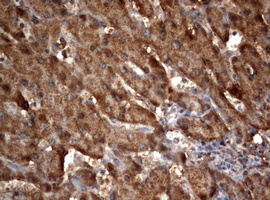 OXSM / KS Antibody - IHC of paraffin-embedded Human liver tissue using anti-OXSM mouse monoclonal antibody.