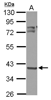 OXSM / KS Antibody - Sample (30 ug of whole cell lysate) A: HeLa 10% SDS PAGE OXSM antibody diluted at 1:3000