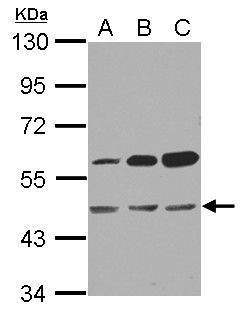 OXSM / KS Antibody - Sample (30 ug of whole cell lysate) A: A431 B: HeLa C: HepG2 10% SDS PAGE OXSM antibody diluted at 1:1000