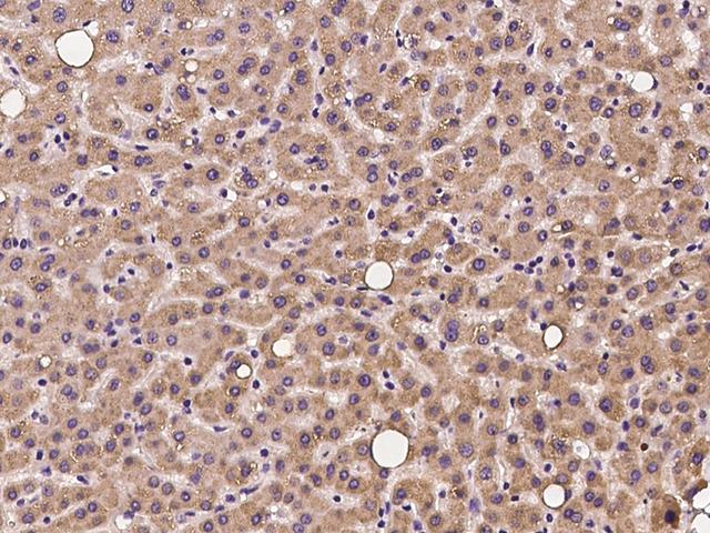 OXSM / KS Antibody - Immunochemical staining of human OXSM in human liver with rabbit polyclonal antibody at 1:100 dilution, formalin-fixed paraffin embedded sections.