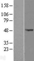 OXSM / KS Protein - Western validation with an anti-DDK antibody * L: Control HEK293 lysate R: Over-expression lysate