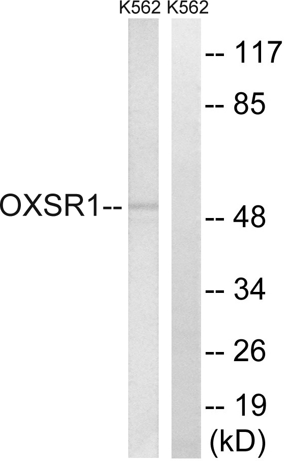 OXSR1 / OSR1 Antibody - Western blot analysis of lysates from K562 cells, using OXSR1 Antibody. The lane on the right is blocked with the synthesized peptide.