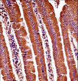 OXSR1 / OSR1 Antibody - Mouse Oxsr1 Antibody immunohistochemistry of formalin-fixed and paraffin-embedded mouse duodenum tissue followed by peroxidase-conjugated secondary antibody and DAB staining.