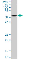 OXSR1 / OSR1 Antibody - OXSR1 monoclonal antibody (M16), clone 3A8. Western blot of OXSR1 expression in PC-12.