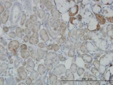 OXSR1 / OSR1 Antibody - Immunoperoxidase of monoclonal antibody to OXSR1 on formalin-fixed paraffin-embedded human salivary gland. [antibody concentration 3 ug/ml]