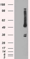 OXSR1 / OSR1 Antibody - HEK293T cells were transfected with the pCMV6-ENTRY control (Left lane) or pCMV6-ENTRY OXSR1 (Right lane) cDNA for 48 hrs and lysed. Equivalent amounts of cell lysates (5 ug per lane) were separated by SDS-PAGE and immunoblotted with anti-OXSR1.