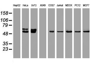 OXSR1 / OSR1 Antibody - Western blot of extracts (35 ug) from 9 different cell lines by using anti-OXSR1 monoclonal antibody.