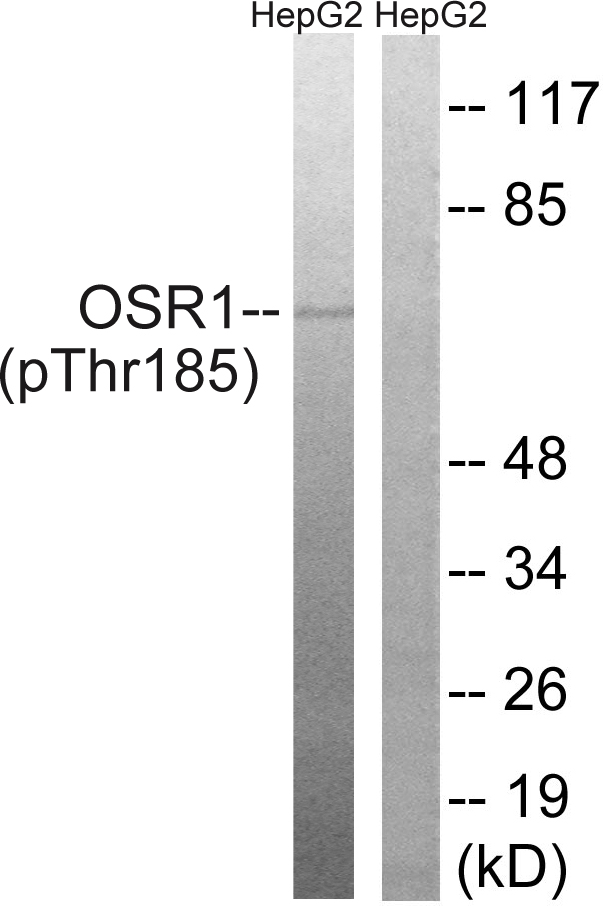 OXSR1 / OSR1 Antibody - Western blot analysis of lysates from HepG2 cells treated with serum 20% 15', using OSR1 (Phospho-Thr185) Antibody. The lane on the right is blocked with the phospho peptide.