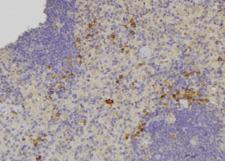 OXSR1 / OSR1 Antibody - 1:100 staining human lymph node tissue by IHC-P. The sample was formaldehyde fixed and a heat mediated antigen retrieval step in citrate buffer was performed. The sample was then blocked and incubated with the antibody for 1.5 hours at 22°C. An HRP conjugated goat anti-rabbit antibody was used as the secondary.