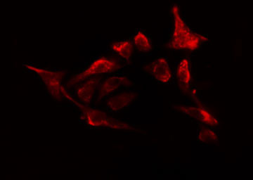 OXSR1 / OSR1 Antibody - Staining HepG2 cells by IF/ICC. The samples were fixed with PFA and permeabilized in 0.1% Triton X-100, then blocked in 10% serum for 45 min at 25°C. The primary antibody was diluted at 1:200 and incubated with the sample for 1 hour at 37°C. An Alexa Fluor 594 conjugated goat anti-rabbit IgG (H+L) antibody, diluted at 1/600, was used as secondary antibody.
