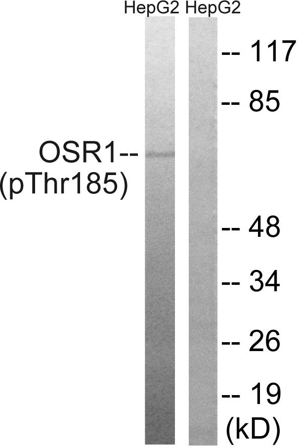 OXSR1 / OSR1 Antibody - Western blot analysis of extracts from HepG2 cells, treated with serum (20%, 15mins), using OSR1 (Phospho-Thr185) antibody.