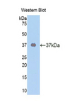 OXTR / Oxytocin Receptor Antibody - Western blot of recombinant OXTR / Oxytocin Receptor.  This image was taken for the unconjugated form of this product. Other forms have not been tested.