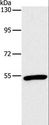 OXTR / Oxytocin Receptor Antibody - Western blot analysis of Mouse heart tissue, using OXTR Polyclonal Antibody at dilution of 1:866.