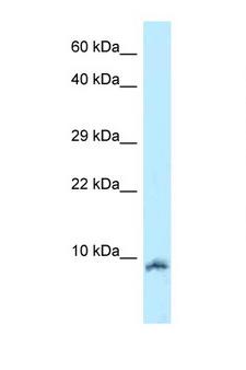 Oxytocin Antibody - OXT / Oxytocin antibody Western blot of Jurkat Cell lysate. Antibody concentration 1 ug/ml.  This image was taken for the unconjugated form of this product. Other forms have not been tested.