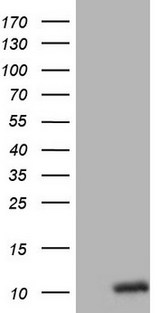 Oxytocin Antibody - HEK293T cells were transfected with the pCMV6-ENTRY control. (Left lane) or pCMV6-ENTRY OXT. (Right lane) cDNA for 48 hrs and lysed. Equivalent amounts of cell lysates. (5 ug per lane) were separated by SDS-PAGE and immunoblotted with anti-OXT. (1:2000)