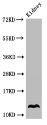 Oxytocin Antibody - Positive WB detected in:Mouse kidney tissue;All lanes:OXT antibody at 3.4?g/ml;Secondary;Goat polyclonal to rabbit IgG at 1/50000 dilution;Predicted band size: 13 KDa;Observed band size: 13 KDa;