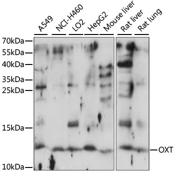 Oxytocin Antibody - Western blot analysis of extracts of various cell lines, using OXT antibody at 1:1000 dilution. The secondary antibody used was an HRP Goat Anti-Rabbit IgG (H+L) at 1:10000 dilution. Lysates were loaded 25ug per lane and 3% nonfat dry milk in TBST was used for blocking. An ECL Kit was used for detection and the exposure time was 30s.