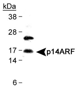 p14ARF / CDKN2A Antibody - Detection of CDKN2A isoform 4 in HeLa cell lysates with antibody.  This image was taken for the unconjugated form of this product. Other forms have not been tested.