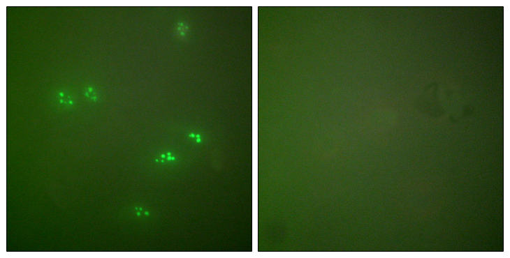 p14ARF / CDKN2A Antibody - Immunofluorescence analysis of HeLa cells, using p14 ARF Antibody. The picture on the right is blocked with the synthesized peptide.