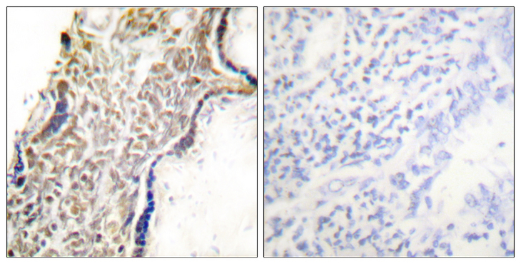 p14ARF / CDKN2A Antibody - Immunohistochemistry analysis of paraffin-embedded human placenta tissue, using p14 ARF Antibody. The picture on the right is blocked with the synthesized peptide.