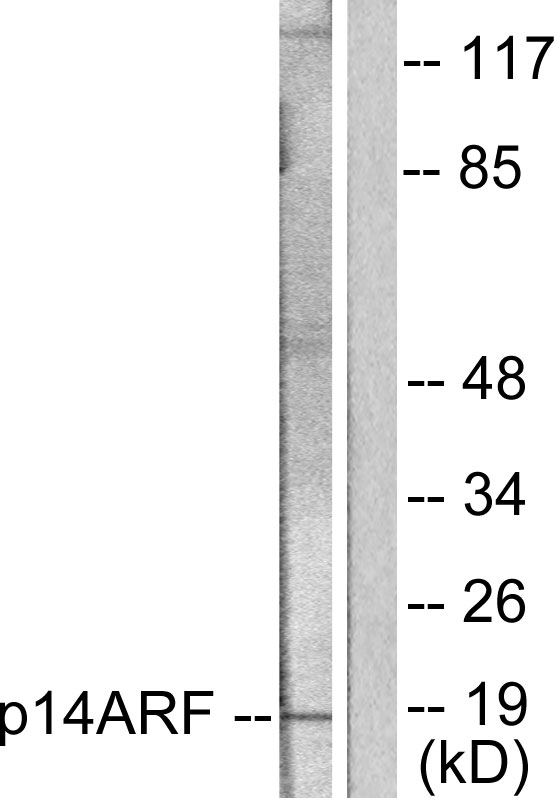p14ARF / CDKN2A Antibody - Western blot analysis of lysates from HeLa cells, using p14 ARF Antibody. The lane on the right is blocked with the synthesized peptide.