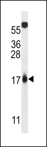 p14ARF / CDKN2A Antibody - MLM Antibody western blot of 293 cell line lysates (35 ug/lane). The MLM antibody detected the MLM protein (arrow).