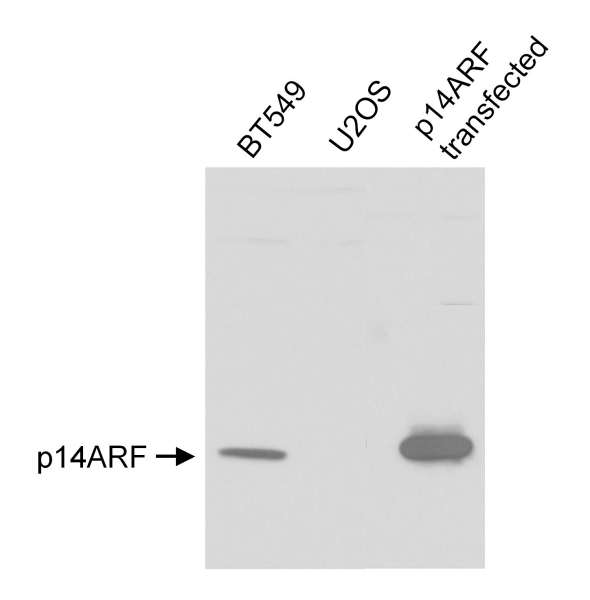 p14ARF / CDKN2A Antibody - Detection of Human p14ARF by Western Blot. Samples: Whole cell lysate (25 ug) from BT549 (positive control), U2OS (negative control) and p14ARF transfected IMR90 cells. Antibody: Affinity purified rabbit anti-p14ARF used at 1 ug/ml. Detection: Chemiluminescence.