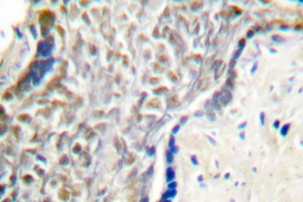 p14ARF / CDKN2A Antibody - IHC of p14 ARF/p19 ARF (Q99) pAb in paraffin-embedded human placenta tissue.