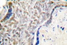 p14ARF / CDKN2A Antibody - IHC of p14 ARF/p19 ARF (Q99) pAb in paraffin-embedded human placenta tissue.