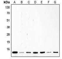 p14ARF / CDKN2A Antibody - Western blot analysis of p14 ARF expression in Saos2 (A); Molt (B); K562 (C); Jurkat (D); HL60 (E); MCF7 (F); HeLa (G) whole cell lysates.
