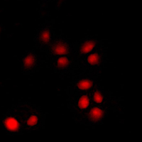 p14ARF / CDKN2A Antibody - Immunofluorescent analysis of p14 ARF staining in K562 cells. Formalin-fixed cells were permeabilized with 0.1% Triton X-100 in TBS for 5-10 minutes and blocked with 3% BSA-PBS for 30 minutes at room temperature. Cells were probed with the primary antibody in 3% BSA-PBS and incubated overnight at 4 C in a humidified chamber. Cells were washed with PBST and incubated with a DyLight 594-conjugated secondary antibody (red) in PBS at room temperature in the dark. DAPI was used to stain the cell nuclei (blue).