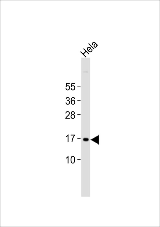 p14ARF / CDKN2A Antibody - Anti-p14 ARF Antibody at 1:1000 dilution + HeLa whole cell lysates Lysates/proteins at 20 ug per lane. Secondary Goat Anti-Rabbit IgG, (H+L),Peroxidase conjugated at 1/10000 dilution Predicted band size : 14 kDa Blocking/Dilution buffer: 5% NFDM/TBST.