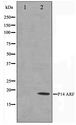p14ARF / CDKN2A Antibody - Western blot of HeLa cell lysate using p14 ARF Antibody
