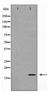 p14ARF / CDKN2A Antibody - Western blot of p14 ARF expression in HeLa cell extract