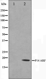 p14ARF / CDKN2A Antibody - Western blot analysis on HeLa cell lysates using p14 ARF antibody. The lane on the left is treated with the antigen-specific peptide.