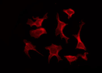 p14ARF / CDKN2A Antibody - Staining HepG2 cells by IF/ICC. The samples were fixed with PFA and permeabilized in 0.1% Triton X-100, then blocked in 10% serum for 45 min at 25°C. The primary antibody was diluted at 1:200 and incubated with the sample for 1 hour at 37°C. An Alexa Fluor 594 conjugated goat anti-rabbit IgG (H+L) Ab, diluted at 1/600, was used as the secondary antibody.