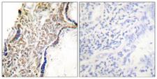 p14ARF / CDKN2A Antibody - Peptide - + Immunohistochemical analysis of paraffin-embedded human placenta tissue using p14 ARF antibody.