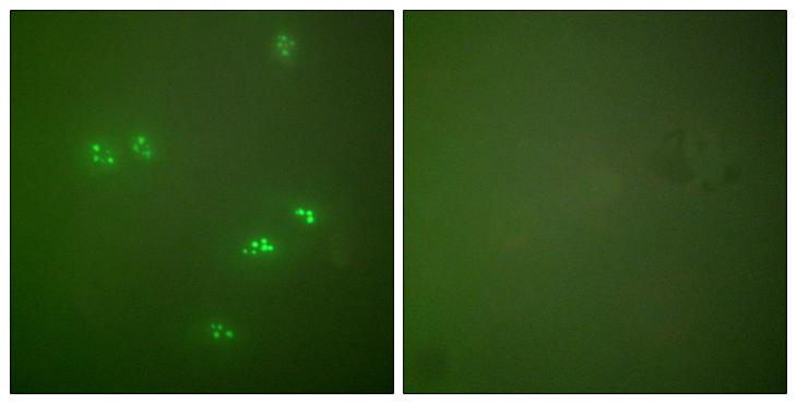 p14ARF / CDKN2A Antibody - Peptide - + Immunofluorescence analysis of HeLa cells, using p14 ARF antibody.
