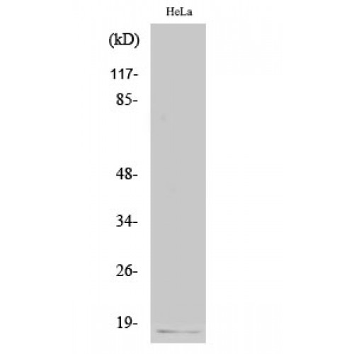 p16INK4a / CDKN2A Antibody - Western blot of p16 antibody