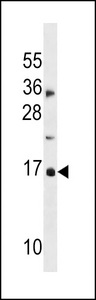 p16INK4a / CDKN2A Antibody - hp16-INK4A Antibody (S7) western blot of MDA-MB453 cell line lysates (35 ug/lane). The CDKN2A antibody detected the CDKN2A protein (arrow).