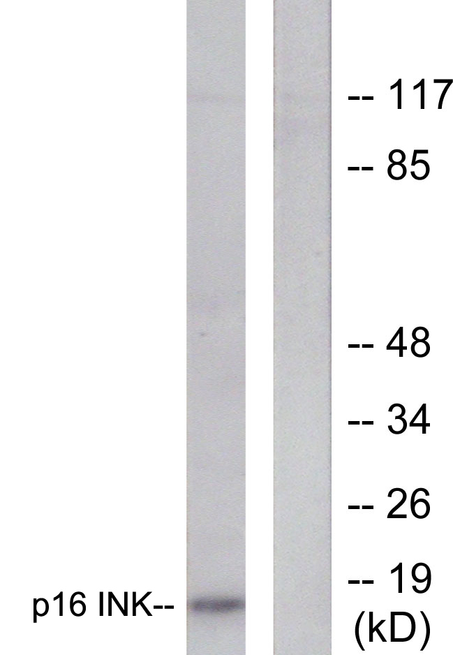 p16INK4a / CDKN2A Antibody - Western blot analysis of lysates from HeLa cells, using p16 INK Antibody. The lane on the right is blocked with the synthesized peptide.