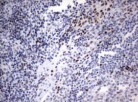 p16INK4a / CDKN2A Antibody - IHC of paraffin-embedded Human tonsil using anti-CDKN2A mouse monoclonal antibody. (Heat-induced epitope retrieval by 10mM citric buffer, pH6.0, 120°C for 3min).