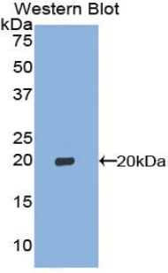 p16INK4a / CDKN2A Antibody - Western blot of recombinant CDKN2A / p16INK4a.  This image was taken for the unconjugated form of this product. Other forms have not been tested.