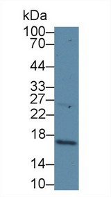 p16INK4a / CDKN2A Antibody - Western Blot; Sample: Human Hela cell lysate; Primary Ab: 1µg/ml Rabbit Anti-Human CDKN2A Antibody Second Ab: 0.2µg/mL HRP-Linked Caprine Anti-Rabbit IgG Polyclonal Antibody